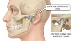 Dáng đi, tư thế, đau vùng mặt: mối liên hệ ít người nghĩ đến từ khớp cắn