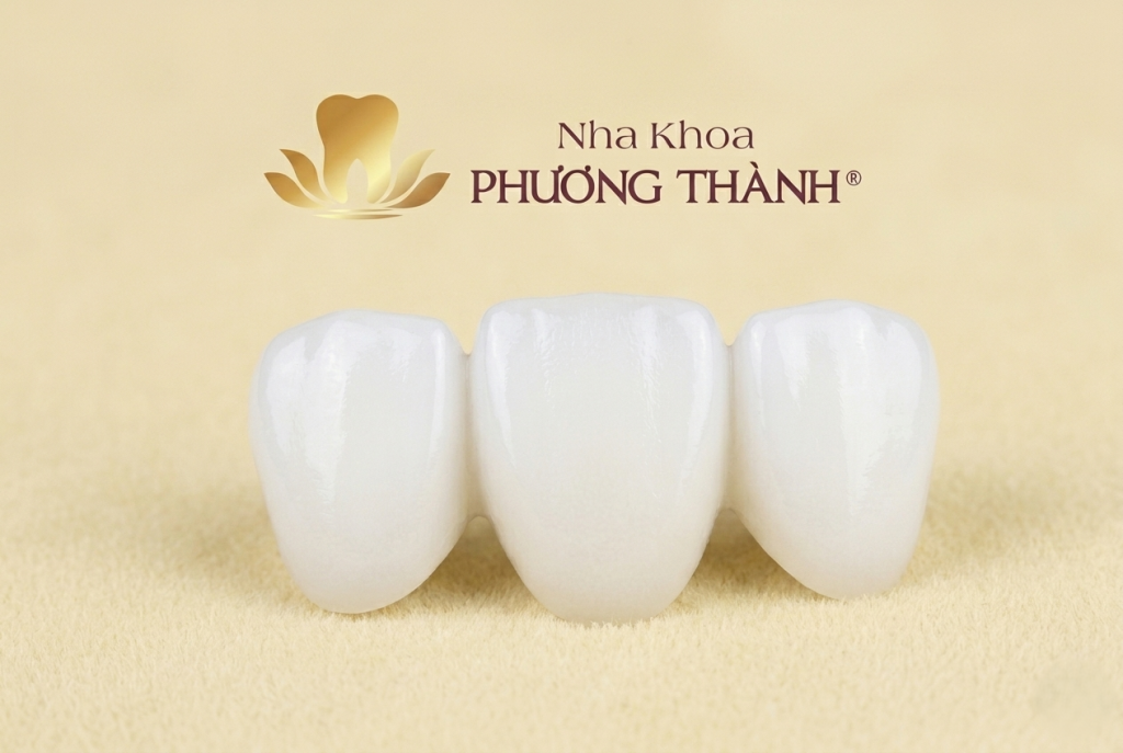 Phục hình răng cửa nhịp ovate – Giải pháp hỗ trợ khôi phục nụ cười tự nhiên