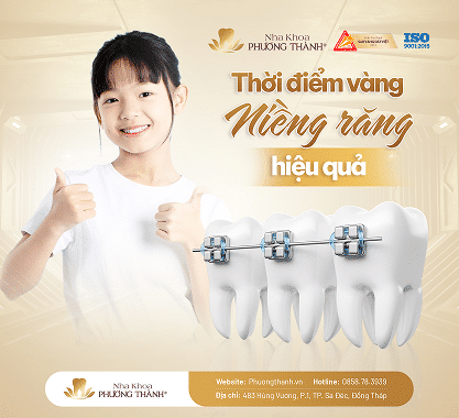 Quá trình niềng răng trẻ em tại nha khoa Phương Thành