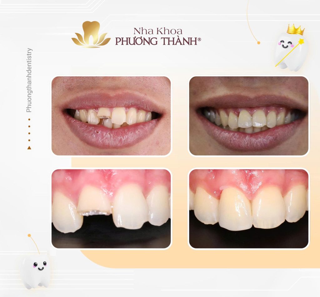 Cosmetic prosthodontics