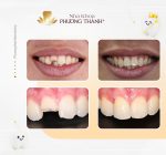 Phục hình thẩm mỹ