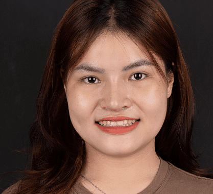 Khách hàng tự tin sai khi chỉnh nha tại nha khoa Phương Thành