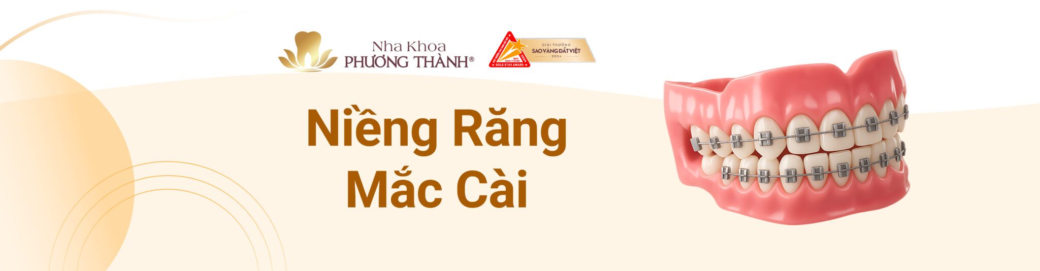 Banner quảng cáo dịch vụ Niềng răng mắc cài tại Nha khoa Phương Thành