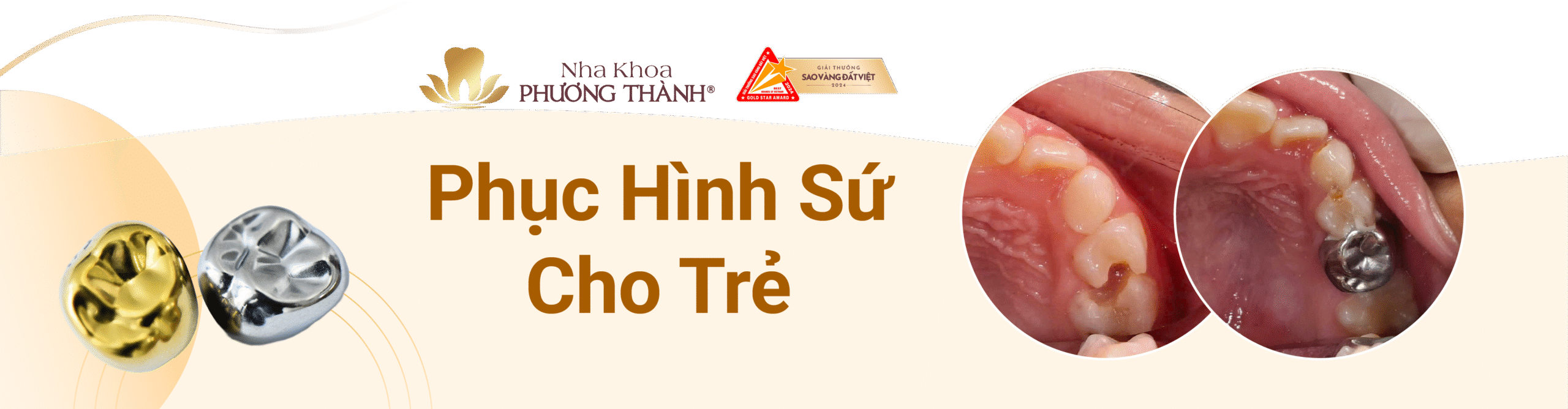 Banner quảng cáo dịch vụ Phục hình sứ cho trẻ tại Nha khoa Phương Thành
