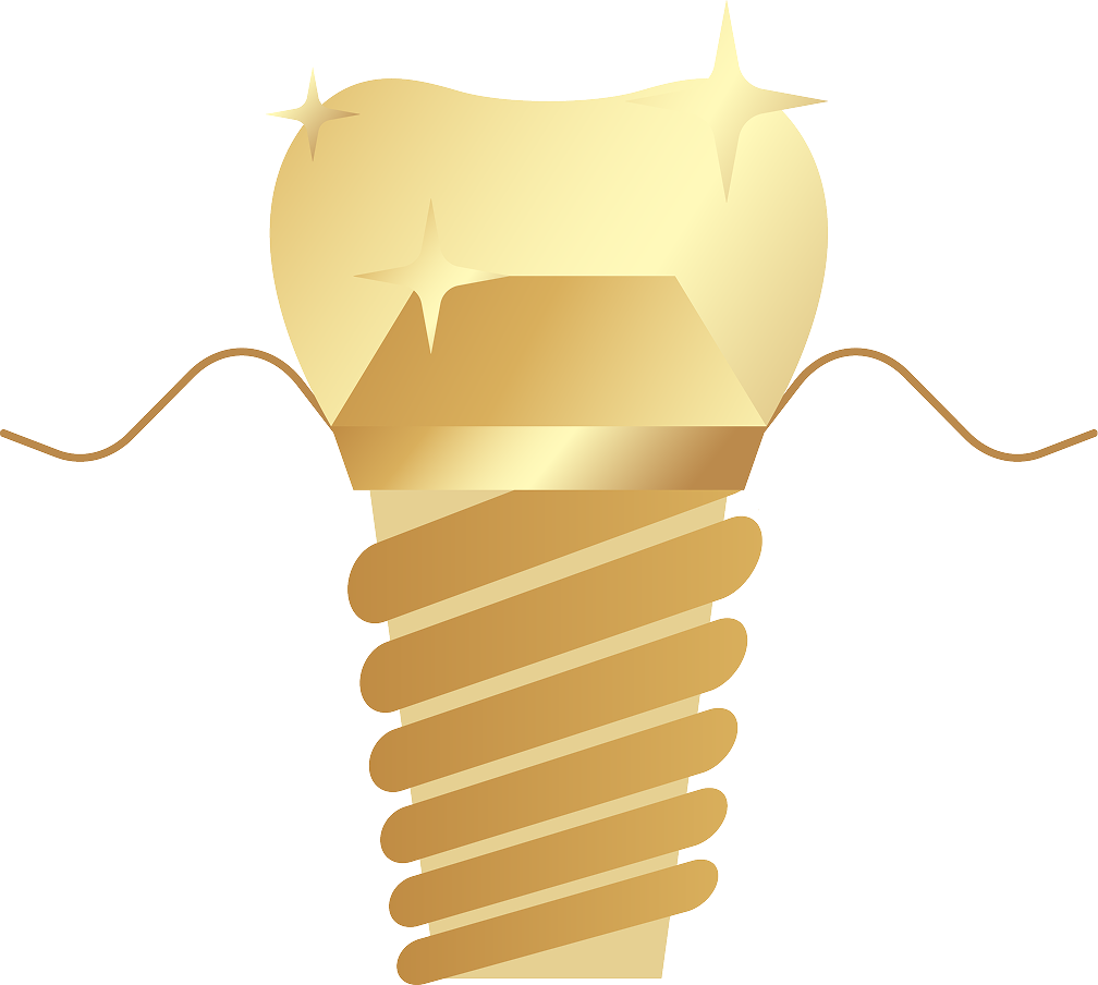 Trụ Implant nha khoa chất liệu cao cấp, minh họa cho dịch vụ cấy ghép Implant và trồng răng giả vĩnh viễn