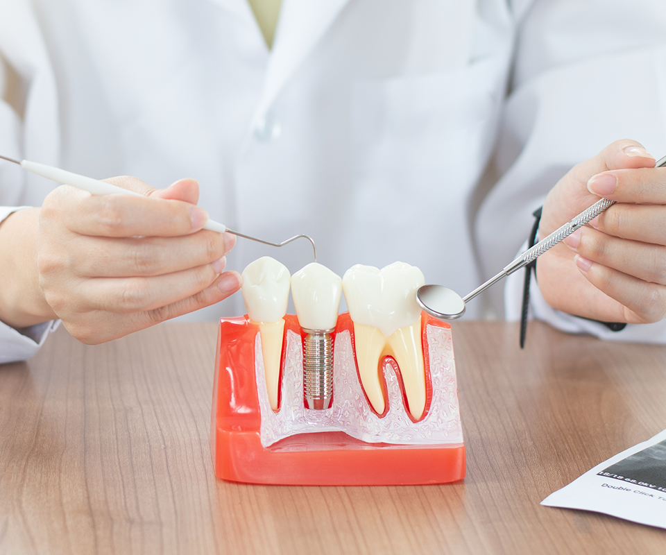 Other Common Dental Issues: