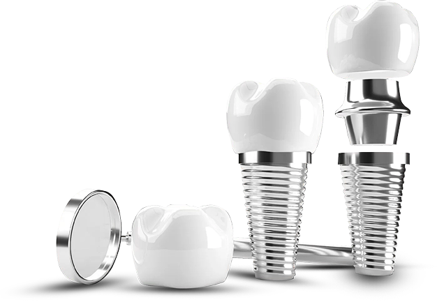 Hình ảnh 3D các bộ phận của Implant nha khoa – gồm trụ titan, khớp nối và mão sứ, minh họa quy trình phục hồi răng giả tại Nha Khoa Phương Thành