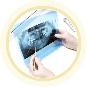 Phân tích phim X-quang răng – kiểm tra sức khỏe răng hàm mặt tại Nha khoa Phương Thành