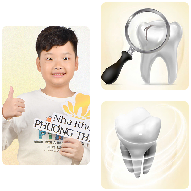 Bé trai vui vẻ sau điều trị nha khoa – cải thiện răng nứt và phục hồi tại Nha Khoa Phương Thu