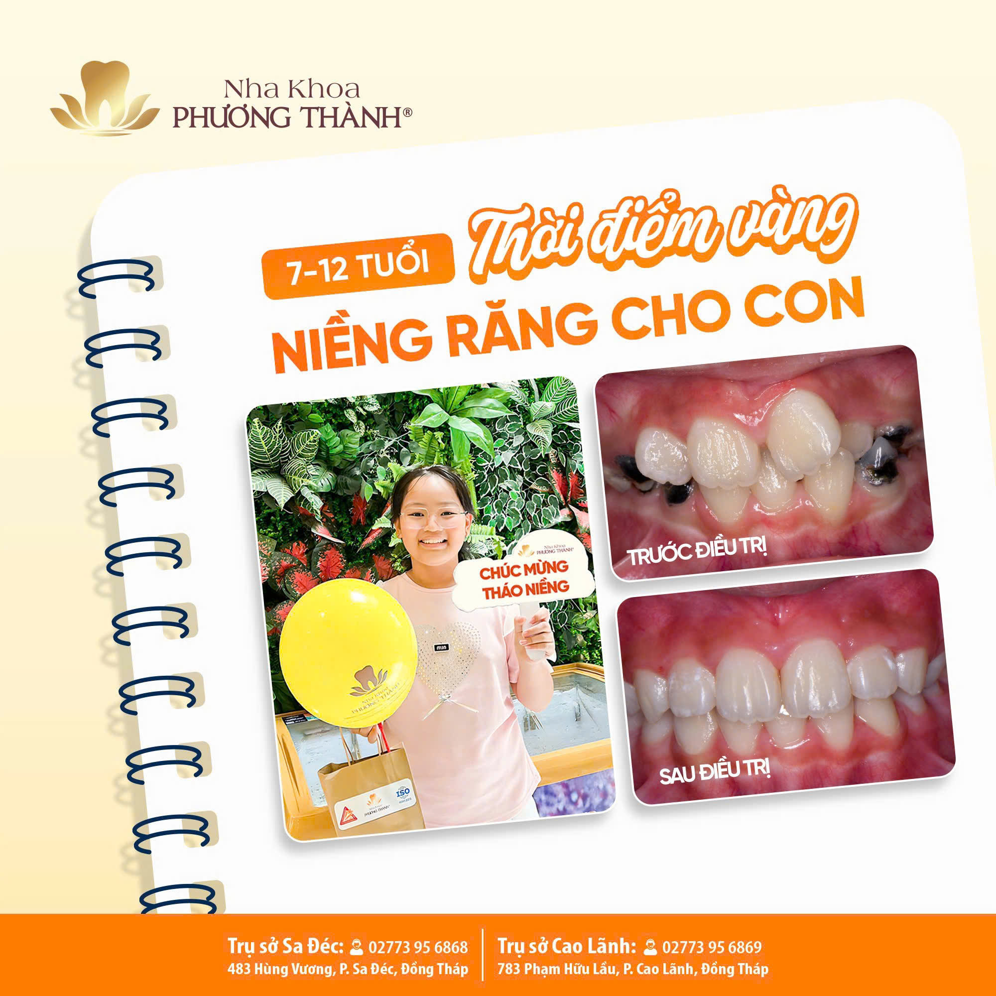 Thời điểm vàng niềng răng cho con
