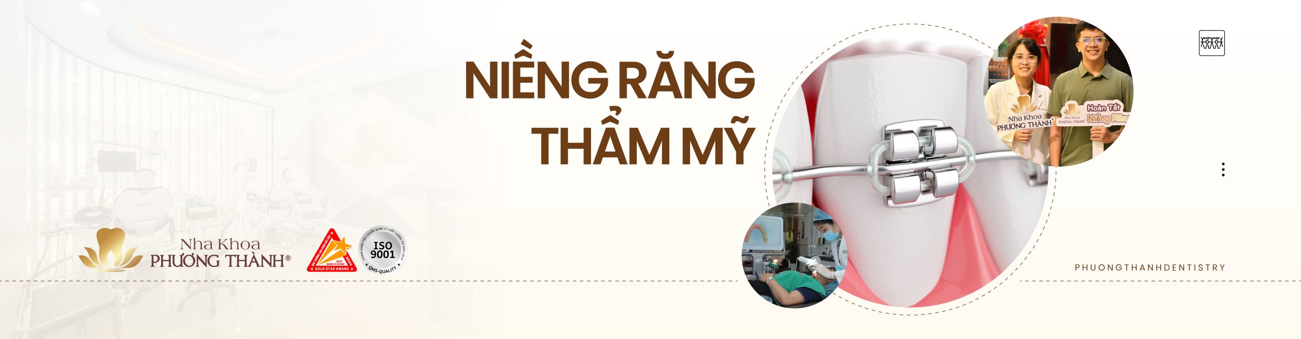 Banner Niềng Răng - Nha khoa Phương Thành