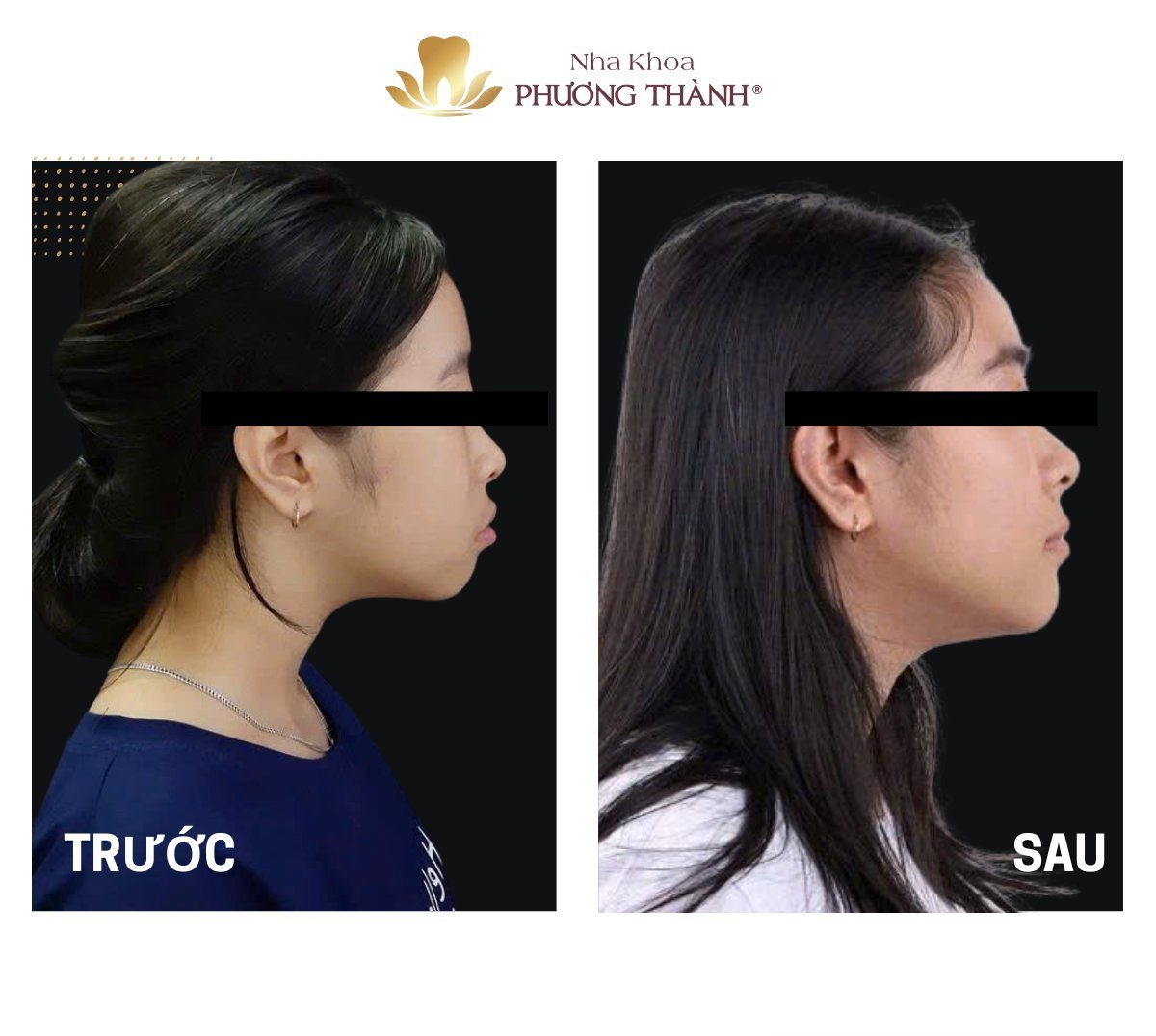 Orthodontics – A Journey of Transforming Teeth and Facial Aesthetics