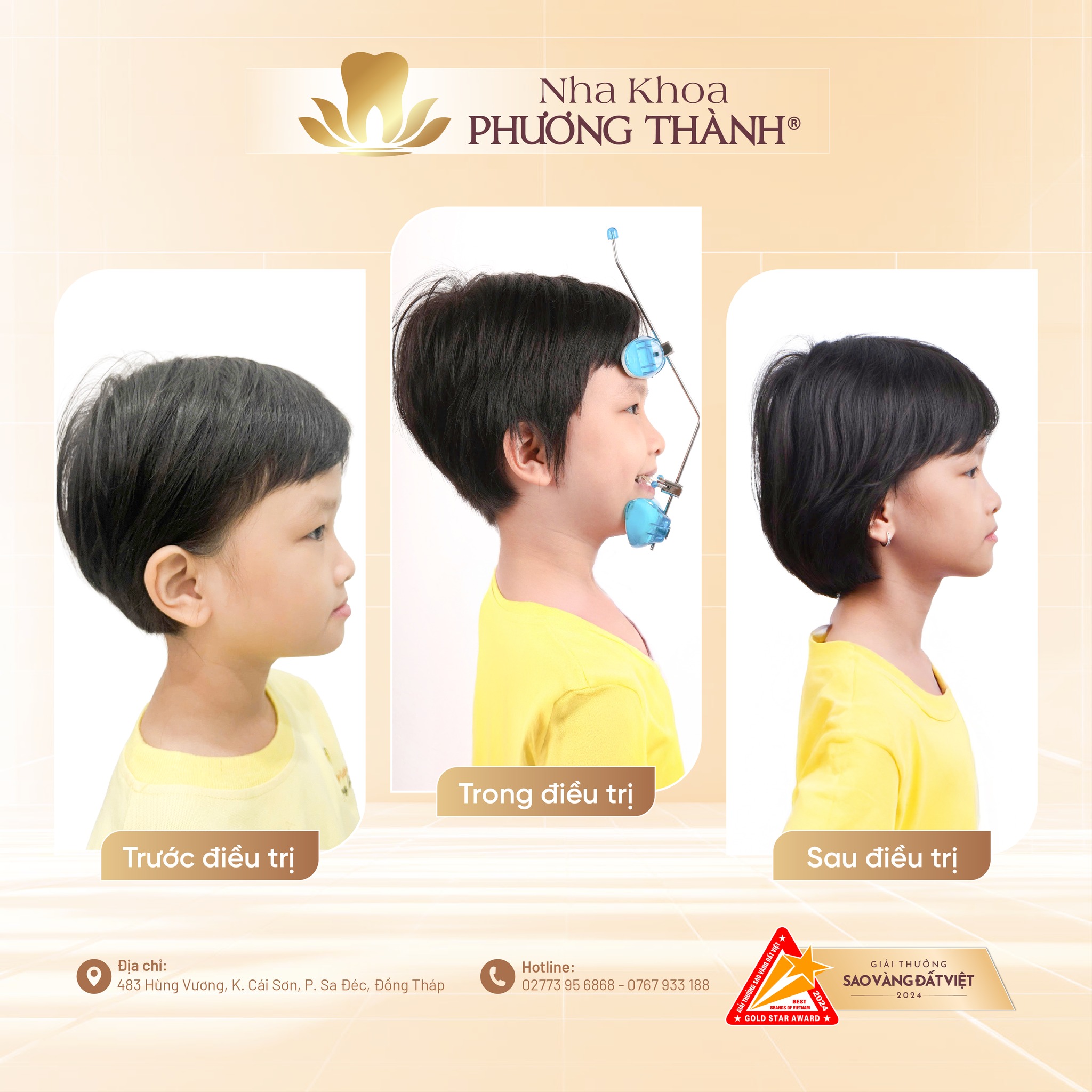 The golden time for early orthodontic treatment in children