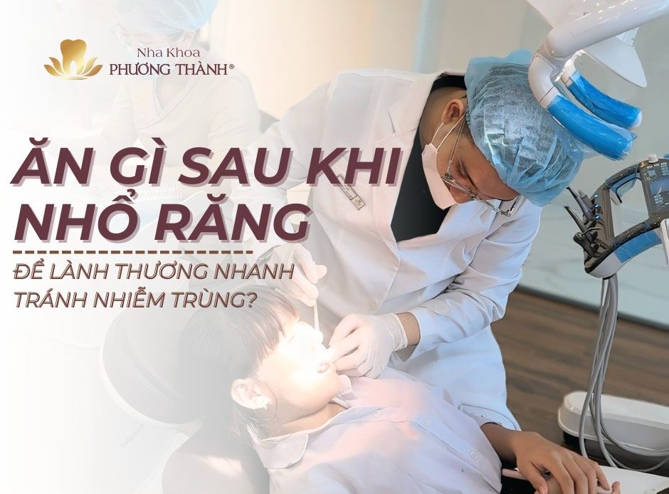 Ăn gì sau khi nhổ răng để hỗ trợ lành thương và giảm nguy cơ biến chứng?