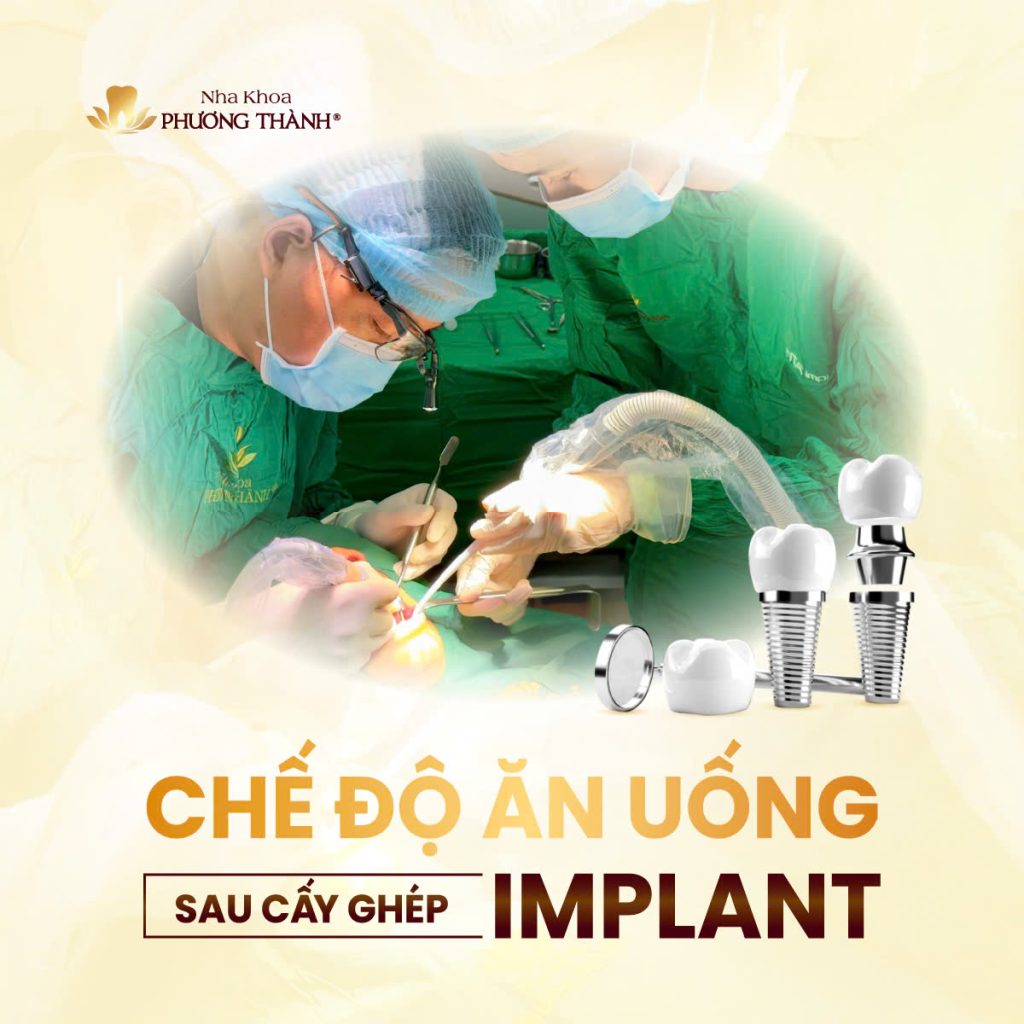 Chế độ ăn uống sau cấy ghép Implant – Ăn đúng để hỗ trợ lành thương tốt hơn