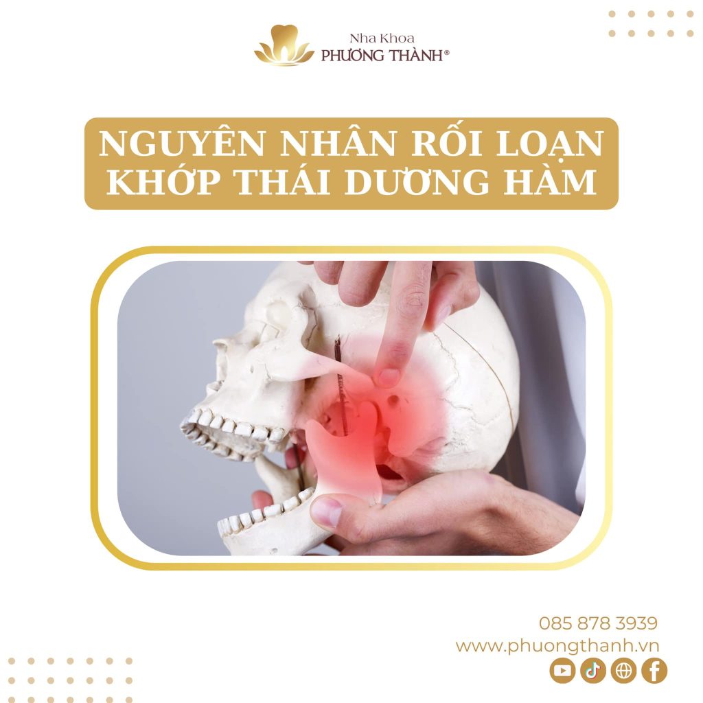 Nguyên nhân dẫn đến tình trạng rối loạn khớp thái dương hàm