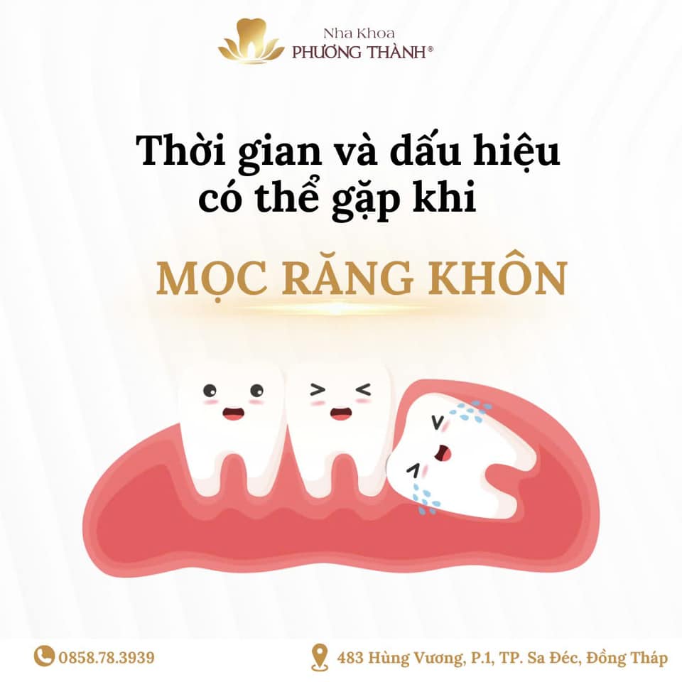 Thời gian và dấu hiệu có thể gặp khi mọc răng khôn