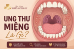 Ung thư miệng: Đừng xem nhẹ một vết loét nhỏ